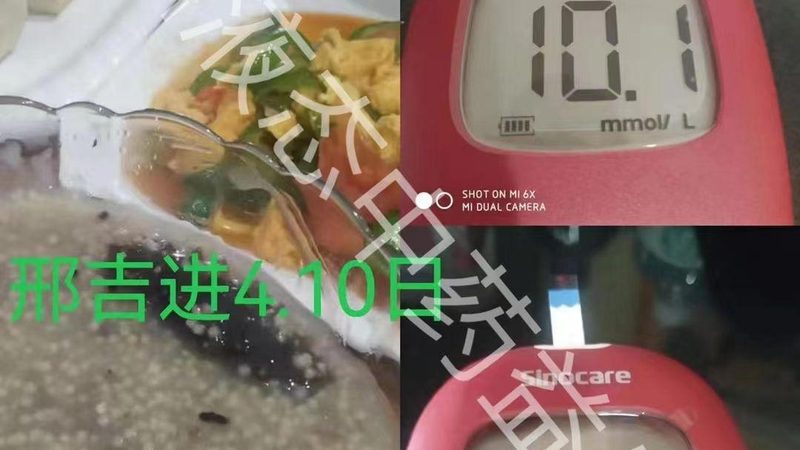 氨糖在骨关节炎治疗中的关键作用及品牌盘点